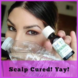 itchy scalp cured
