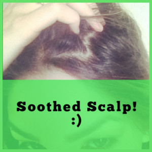 soothed scalp