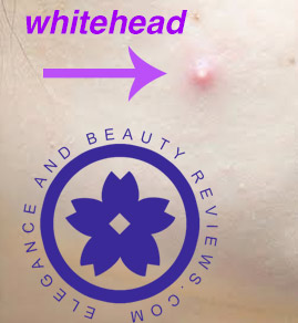 photo of a whitehead