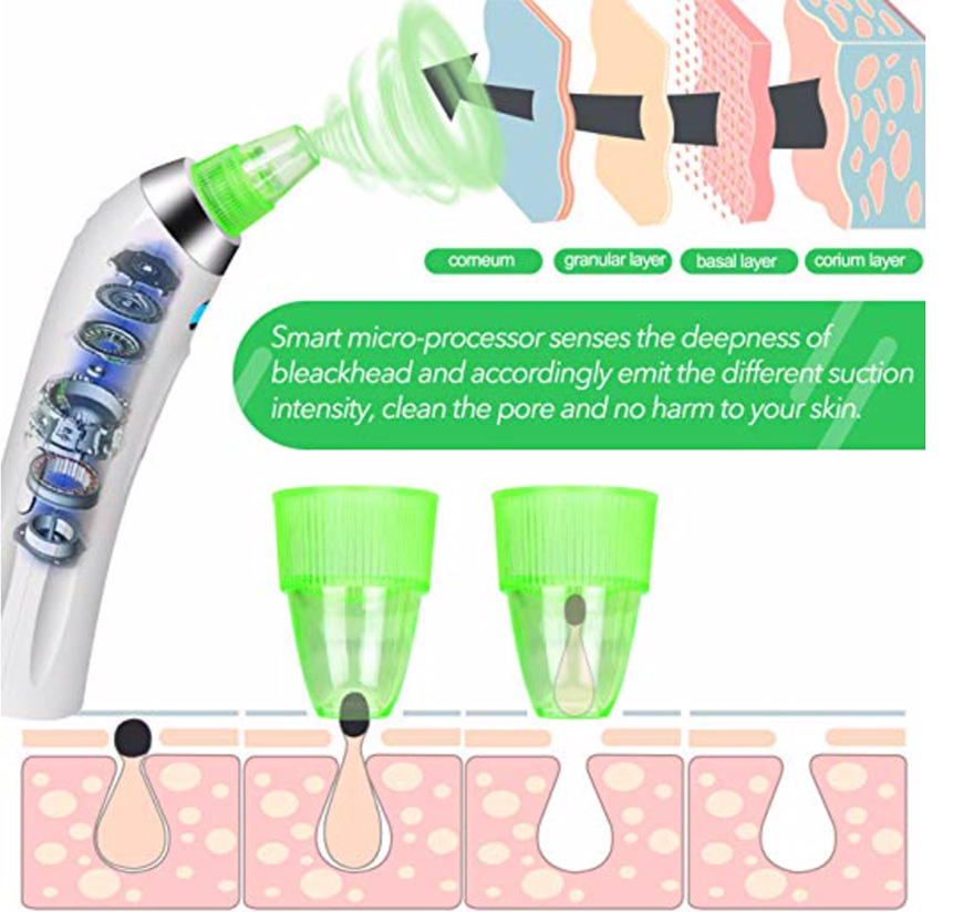 blackhead remover